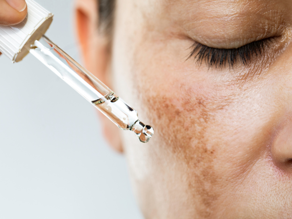 especialidades dermatológicas